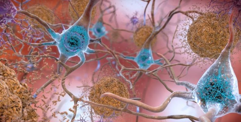 Mesterséges intelligenciával találtak amiloidokat az ELTE kutatói